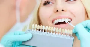 Read more about the article Modern Home Teeth Whitening: Science-Backed Methods for a Brighter Smile