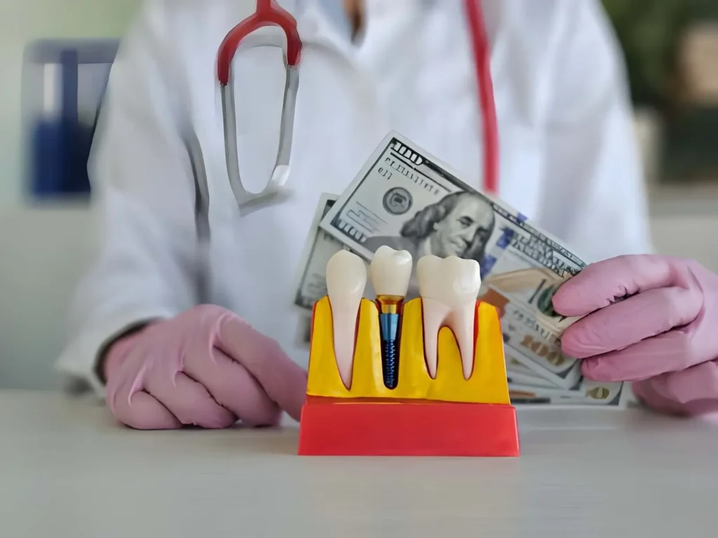 Exploring Payment Options for Dental Implants: A Comprehensive Guide