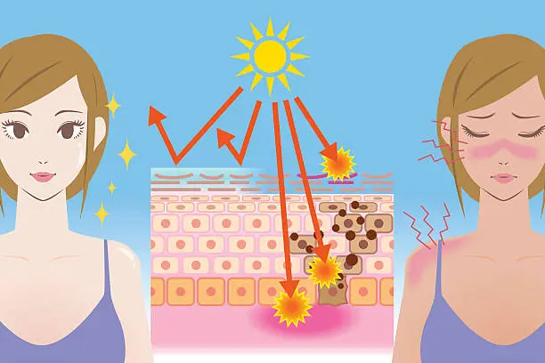 How to Tell If Your Skin Barrier Is Damaged This Summer